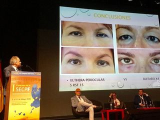 Ponencia del dr. Alvarez-Marín en el congreso de cirugía plástica Rejuvenecimiento periocular