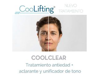 Tratamiento coolclear