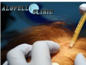 Alopell Clinic