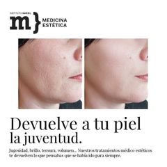 Rejuvenecimiento facial - Instituto Marsil