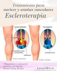 Clínica Lasernova León escleroterapia