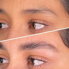 Microblading - Clínica Lasernova