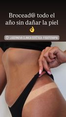 Clínica Lasernova bronceado Hollywood