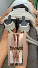 tratamiento drenaje linfático ,lipedema