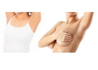 Lifting Brazos (branquioplastia)