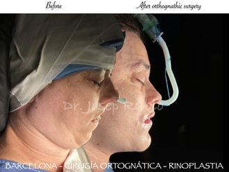 Cirugía maxilofacial - 859122