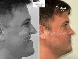 Cirugía maxilofacial antes y después - 862202