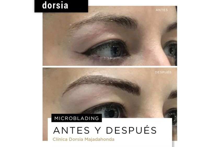 Microblading antes y después - 702169