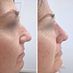 Clínica Carlos Gómez - rinomodelacion