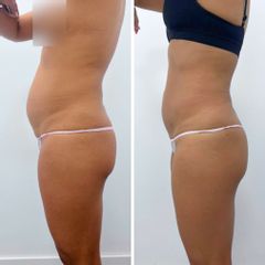 Clínica Carlos Gómez - tratamiento reductor