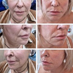 Clínica Carlos Gómez - Rejuvenecimiento