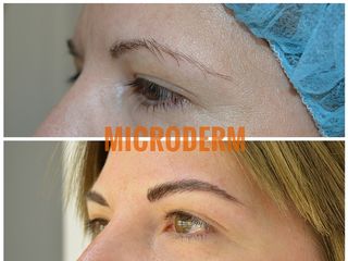Antes y después Micropigmentación de cejas