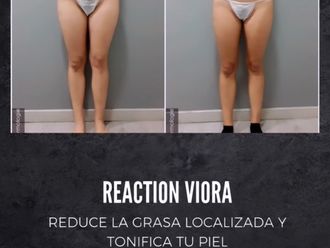 Eliminar grasa localizada antes y después - 877730