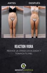 Eliminar grasa localizada - Session Estética