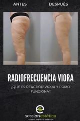 Eliminar grasa localizada -  Session Estética