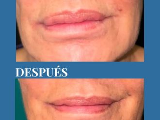 Cirugía reconstructiva antes y después - 881239