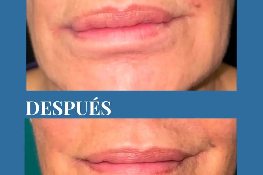 Cirugía reconstructiva antes y después - 881239