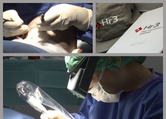 TRICOsolutions lo más novedoso en tratamiento para la calvicie