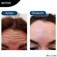 Botox New York Clinic
