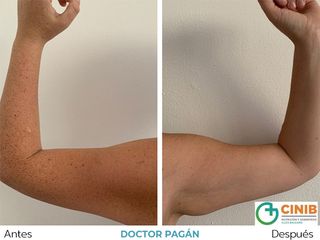 Tratamiento obesidad - Dr. Alberto Pagán