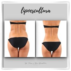 Doctor Terán & Doctora Zavalloni - Lipoescultura