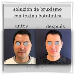 Doctor Terán & Doctora Zavalloni - Toxina botulínica