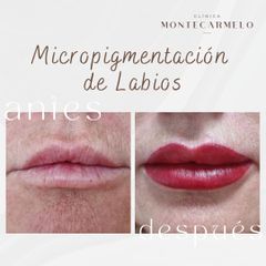 Micropigmentación - Clínica Montecarmelo