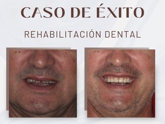 Ortodoncia antes y después - 875700