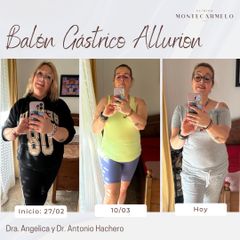 Clínica Montecarmelo - Balón gástrico