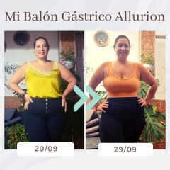 Clínica Montecarmelo - Balón gástrico