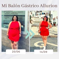 Clínica Montecarmelo - Balón gástrico