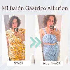 Clínica Montecarmelo - Balón gástrico