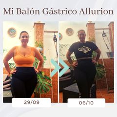 Clínica Montecarmelo - Balón gástrico