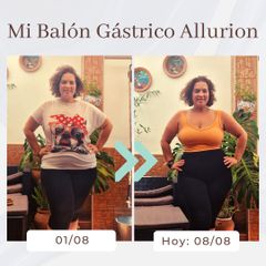 Clínica Montecarmelo - Balón gástrico