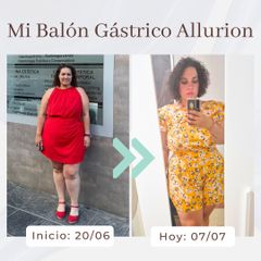 Clínica Montecarmelo - Balón gástrico
