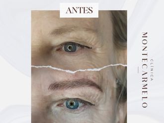 Micropigmentación antes y después - 876112