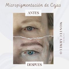 Clínica Montecarmelo - Micropigmentación de Cejas