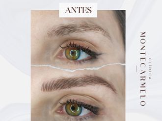 Micropigmentación antes y después - 876113