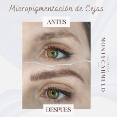 Clínica Montecarmelo - Micropigmentación de Cejas