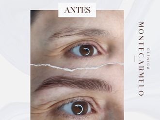 Micropigmentación antes y después - 876114