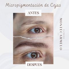 Clínica Montecarmelo - Micropigmentación de Cejas