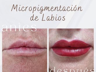Micropigmentación antes y después - 876115