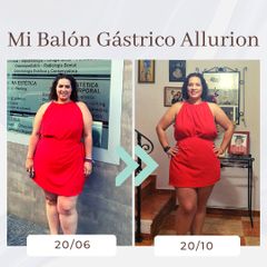 Clínica Montecarmelo - Balón gástrico