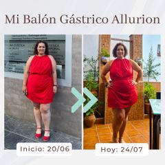 Clínica Montecarmelo - Balón gástrico