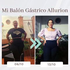 Clínica Montecarmelo - Balón gástrico