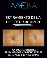HIFU - Clinicas IMEBA®