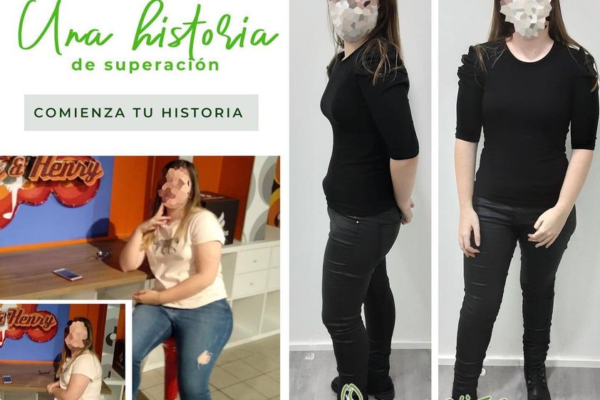 Dietas antes y después - 738450