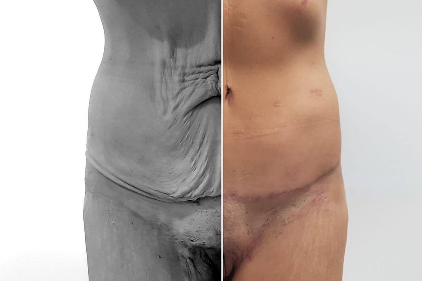 Cirugía reconstructiva antes y después - 851896