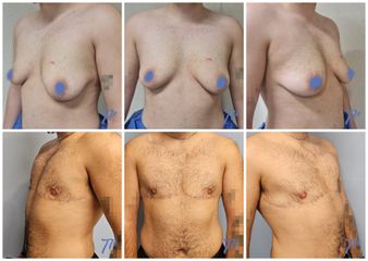 Cambio de sexo - Dr. José María Triviño Fernández