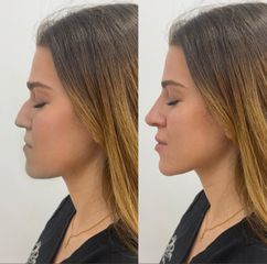 Dra. Paula Catena Medicina Estética - armonización facial